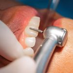 How a Cosmetic Dentist Adelaide Can Boost Your Confidence